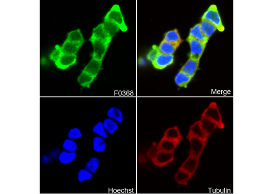 βIII-Tubulin Antibody