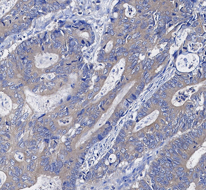 AMPKβ1/2 Antibody