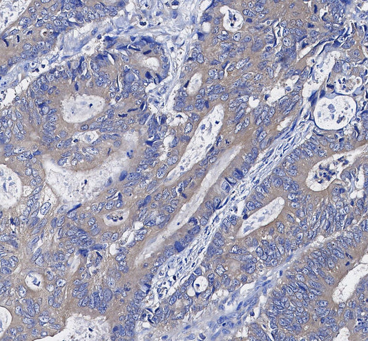 AMPKβ1/2 Antibody