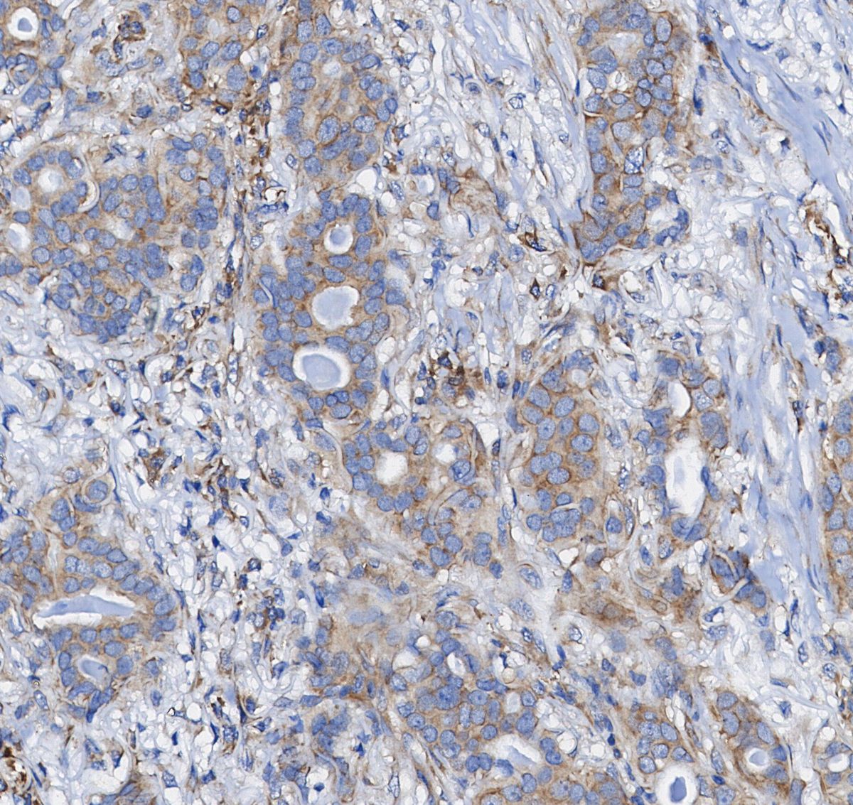 CTCF Antibody