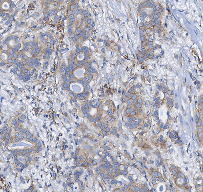 CTCF Antibody