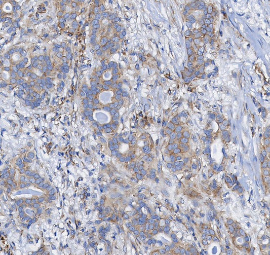 CTCF Antibody