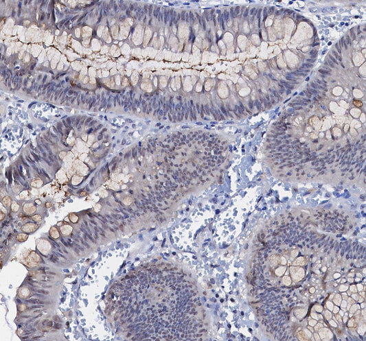 Chk2 Antibody