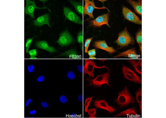 MEF2C Antibody