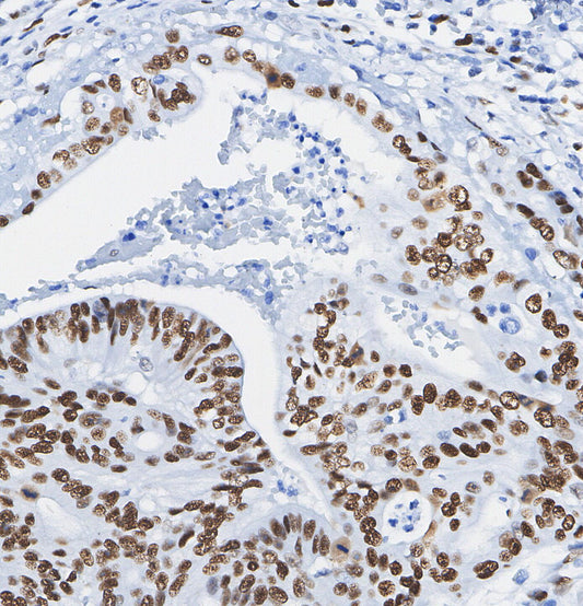 PLK1 Antibody