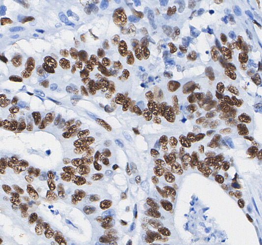 RBPSUH Antibody