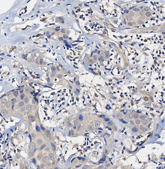 SHP2 Antibody