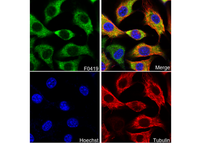 ATGL Antibody