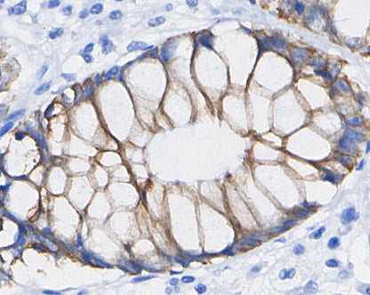 ATGL Antibody