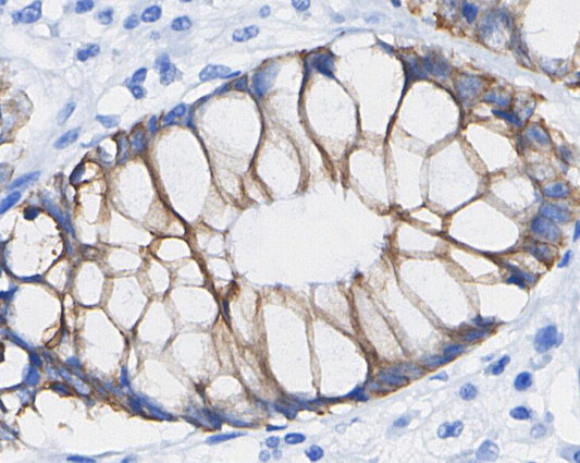 ATGL Antibody