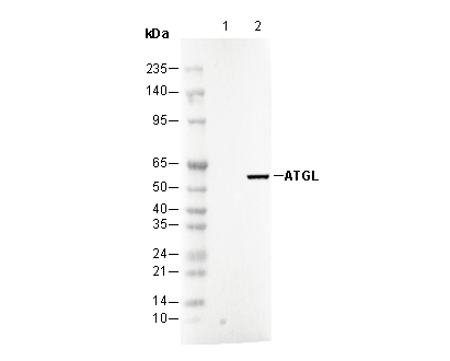 ATGL Antibody