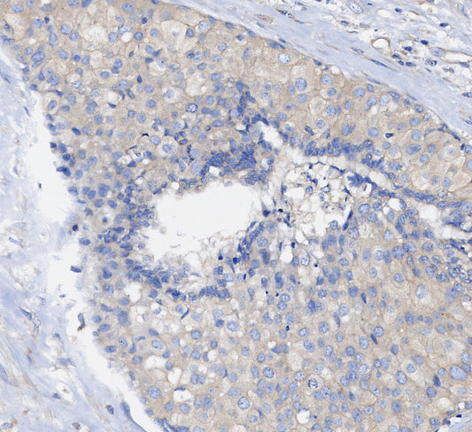 Arginase-1 Antibody