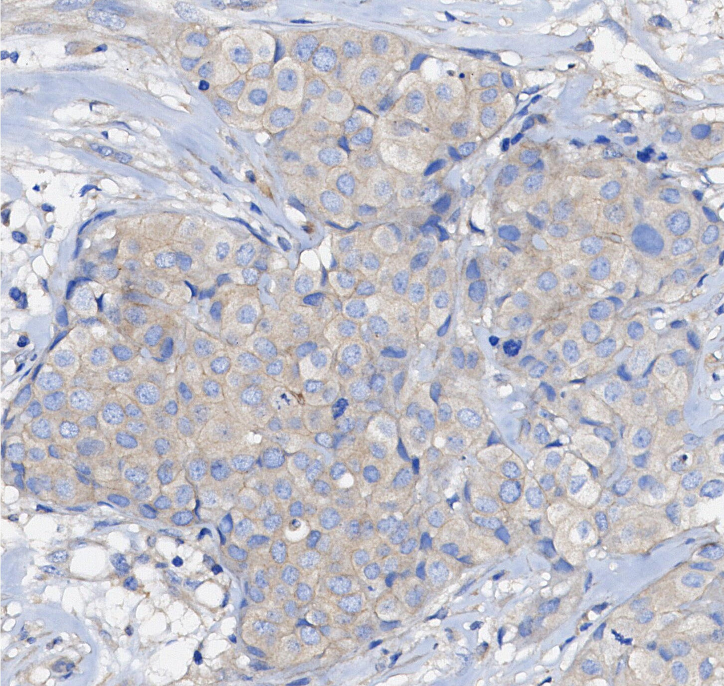 Axin1 Antibody