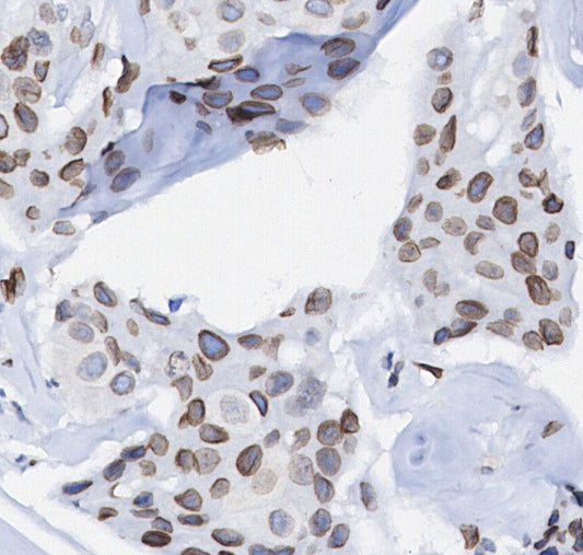Btk Antibody