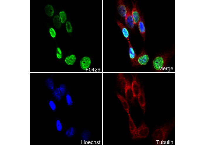 Histone H3 (di methyl Lys36) Antibody