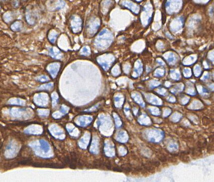HER3/ErbB3 Antibody