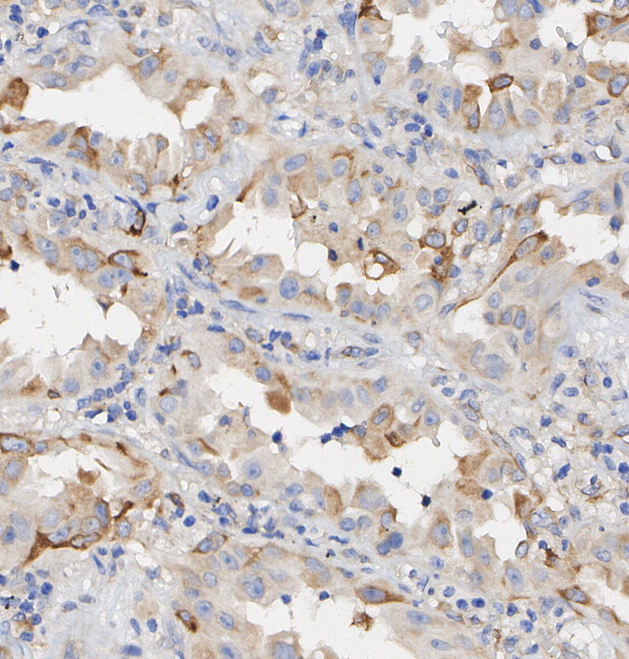 Hexokinase 1 Antibody