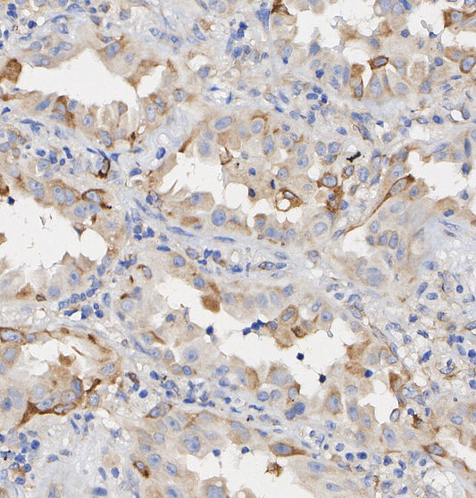 Hexokinase 1 Antibody