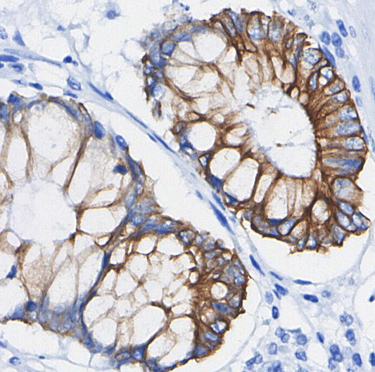 Integrin β3 Antibody