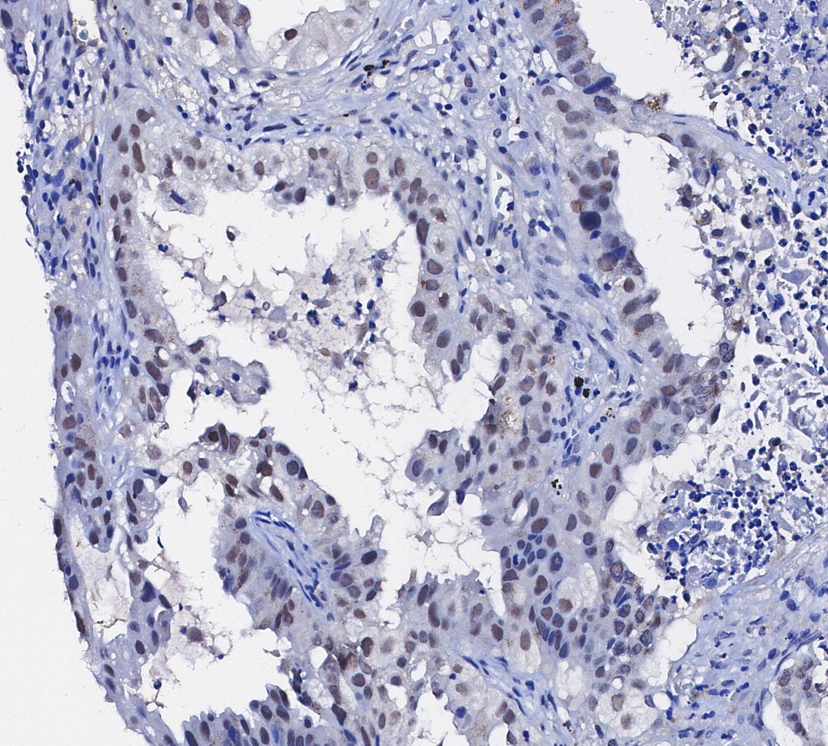 LSD1 Antibody