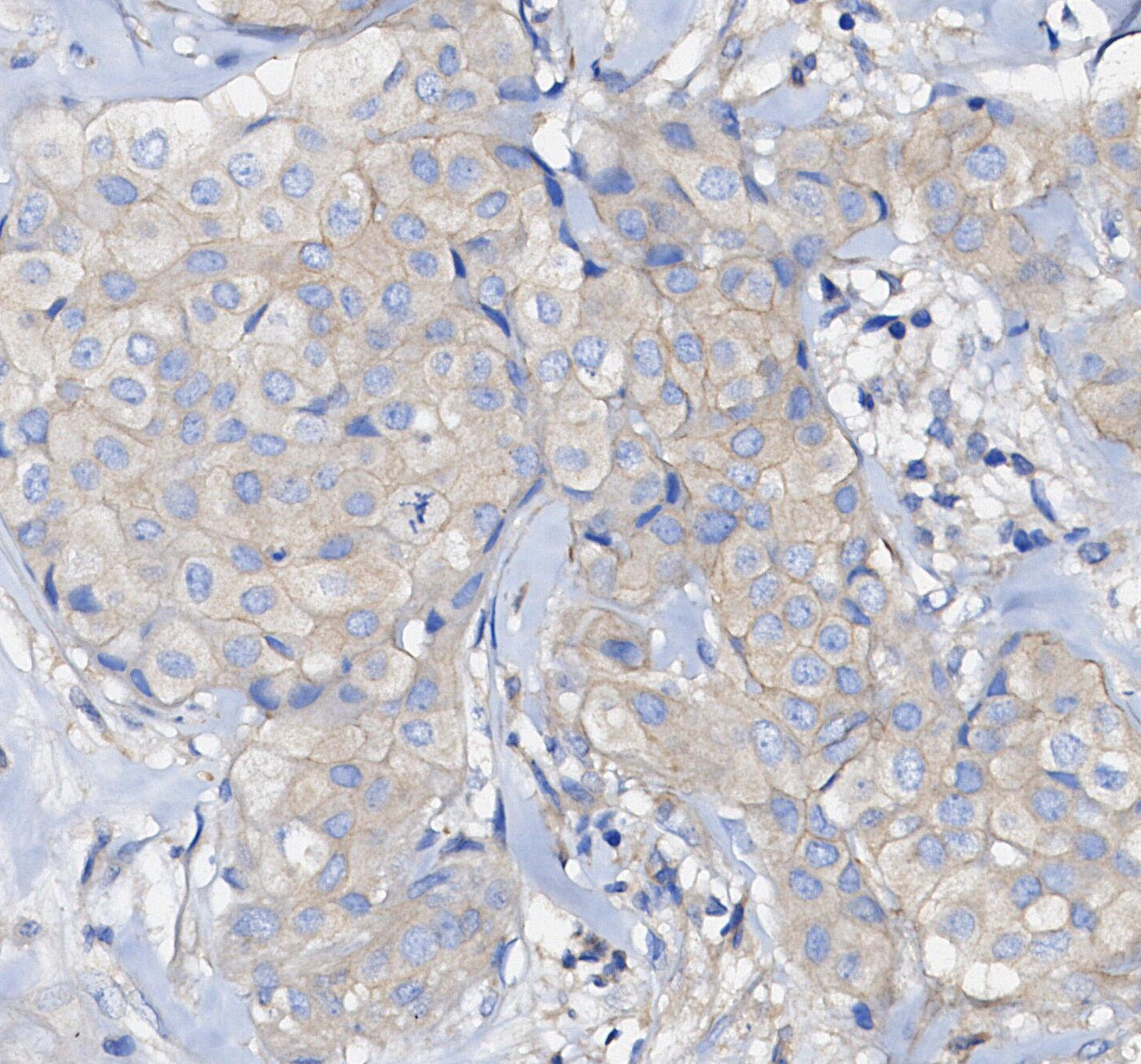 PP2A C Subunit Antibody