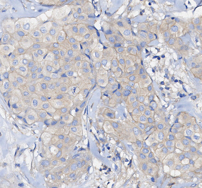 PP2A C Subunit Antibody