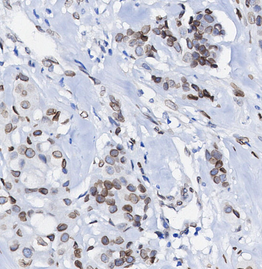 PU.1 Antibody