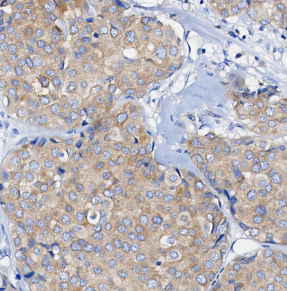 Phospho-NDRG1 (Thr346) Antibody