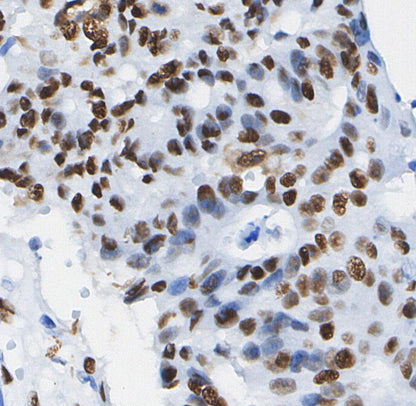 Progesterone Receptor A/B Antibody