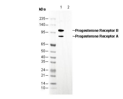 Progesterone Receptor A/B Antibody