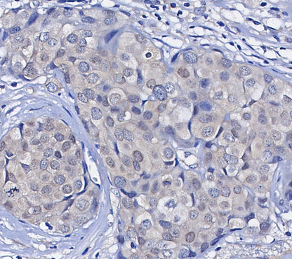 RelB Antibody