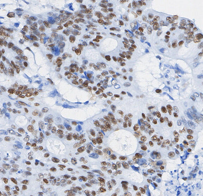TCF1/TCF7 Antibody