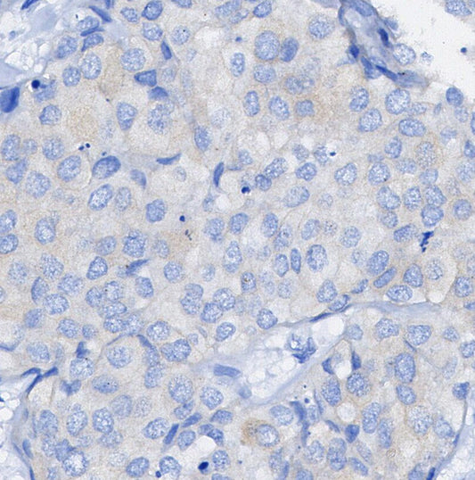 Thioredoxin 1 Antibody