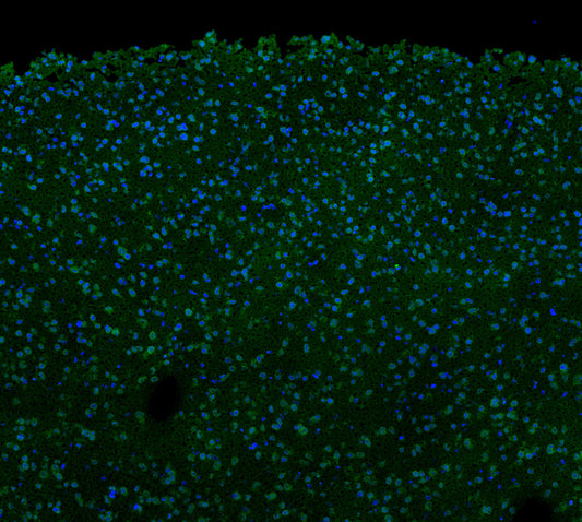 p35/25 Antibody