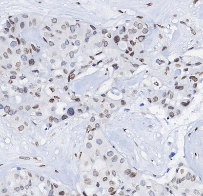 p35/25 Antibody