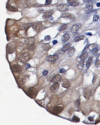 ASC/TMS1 Antibody