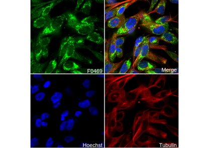 BNIP3L/Nix Antibody