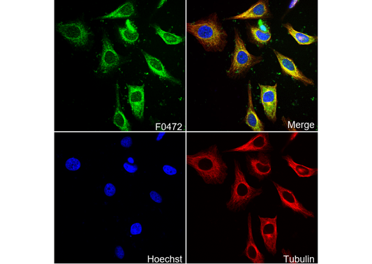 Calreticulin Antibody