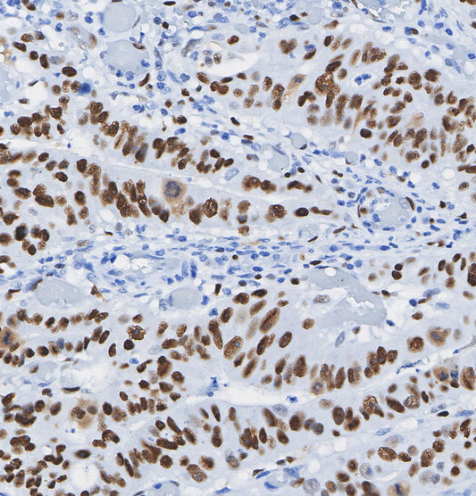 GATA-6 Antibody