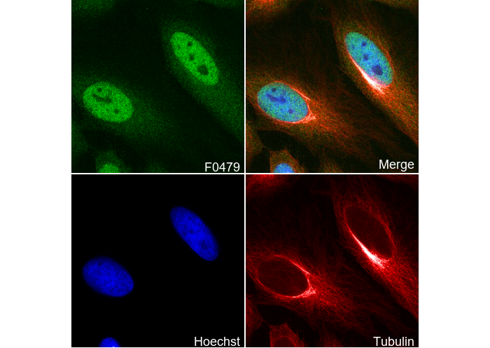 Glucocorticoid Receptor Antibody
