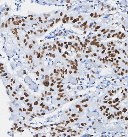 Glucocorticoid Receptor Antibody