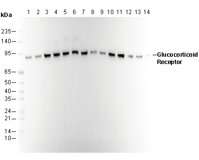 Glucocorticoid Receptor Antibody