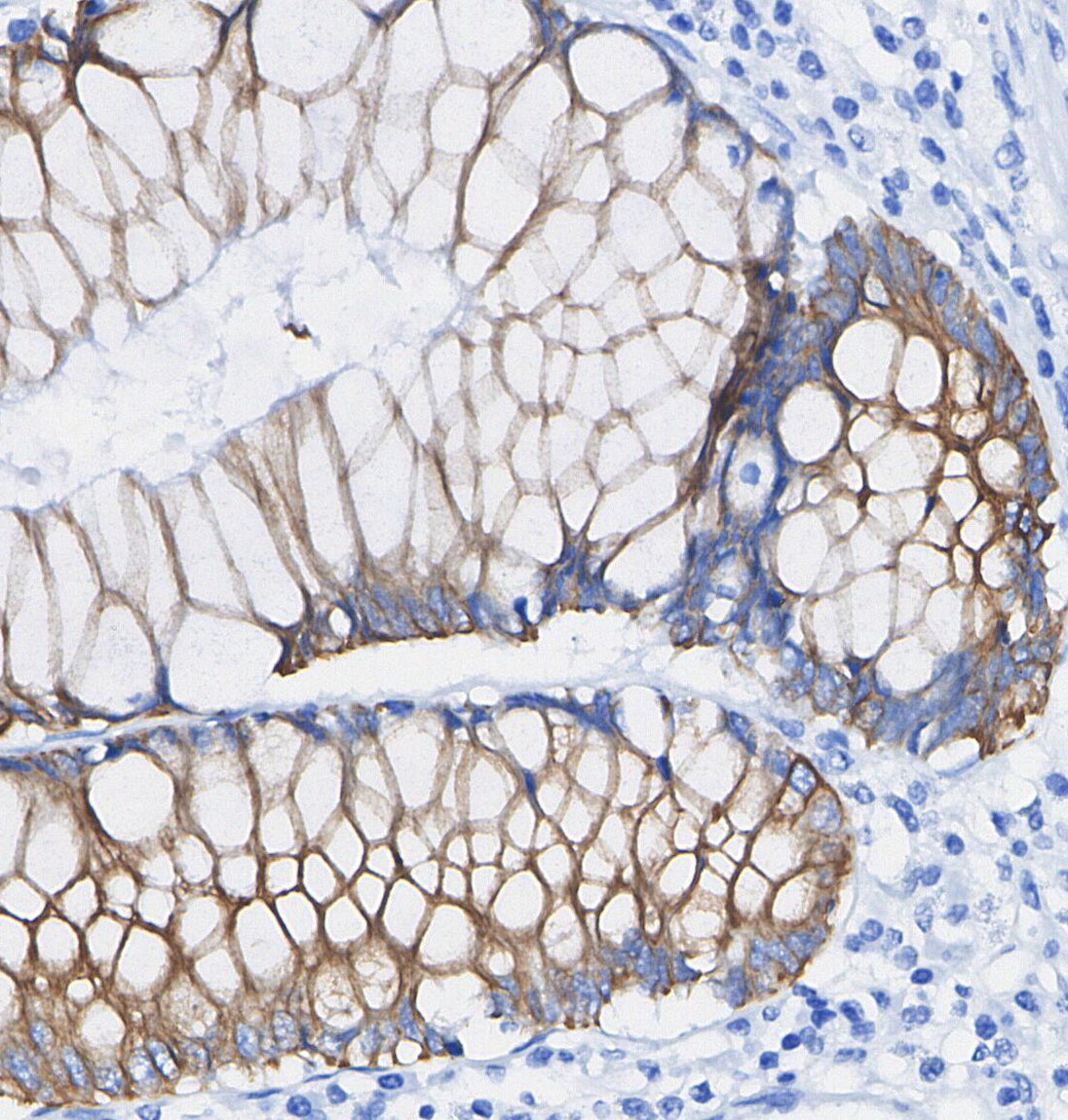 HSP60 Antibody