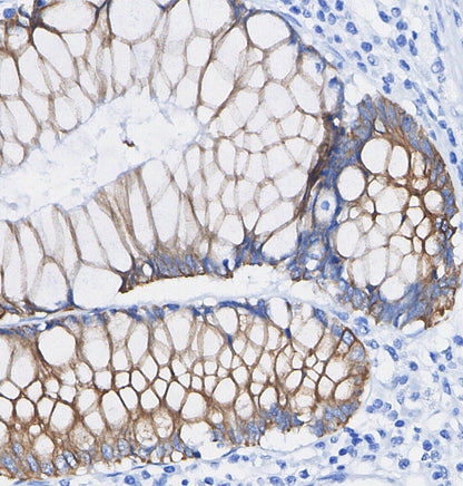 HSP60 Antibody