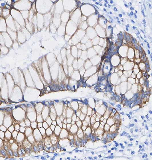 HSP60 Antibody