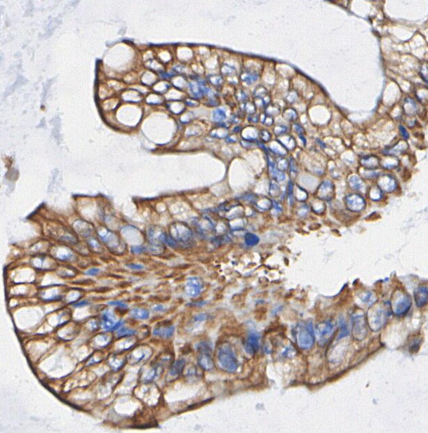 Non-phospho β-Catenin (Ser45) Antibody