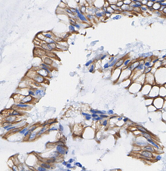 Notch2 Antibody