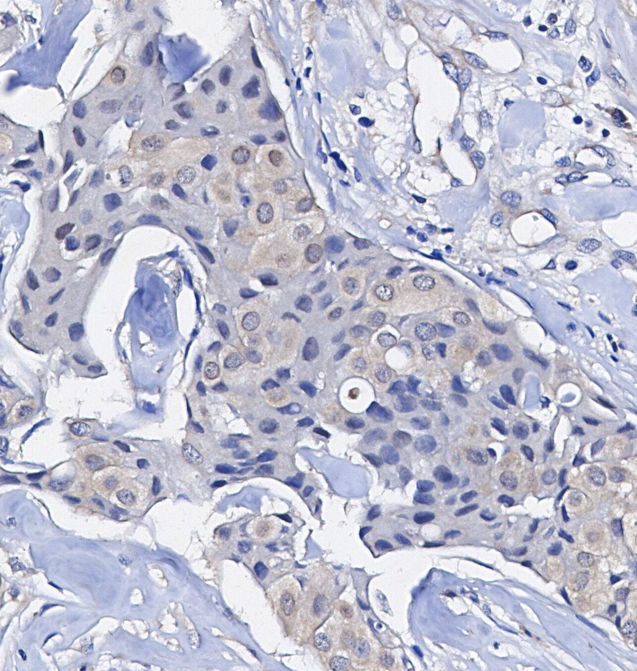 PDCD4 Antibody
