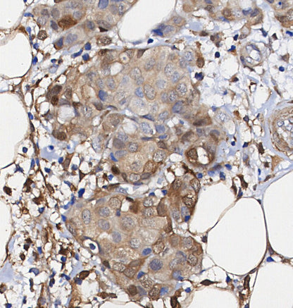PKM1 Antibody
