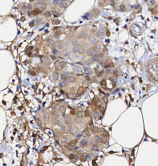 PKM1 Antibody